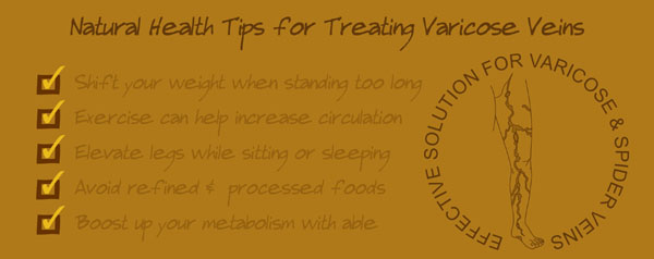 best vitamins supplements for varicose veins, spider veins, pregnancy varicose veins, sclerotherapy, vein stripping, natural remedies removal tips bulging leg 