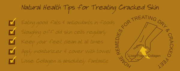 how to cure cracked skin, how to treat cracked heels, vitamins the best cure for cracked skin, ways to cure dry skin, remedy for cracked skin, dry skin treatment