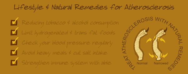 how to prevent atherosclerosis, vitamins supplements atherosclerosis treatment through foods and diet, natural cure for arteriosclerosis from home remedies