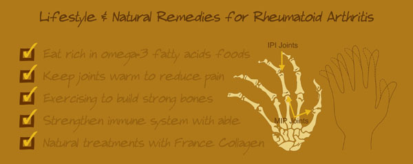 how to treat rheumatoid arthritis, best vitamins and supplements and treatments for psoriatic arthritis, rheum arthritis pain relief treatments for RA tips