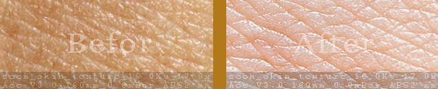 best reviews & top rated anti-aging skin care serum and moisturizer, new treatment for whitening, anti-wrinkle & remove age spots image before and after